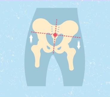 What Causes Our Bodies to Become Out of Alignment?